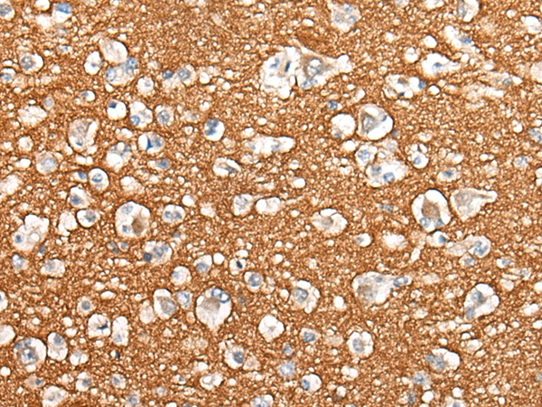 BASP1 Antibody