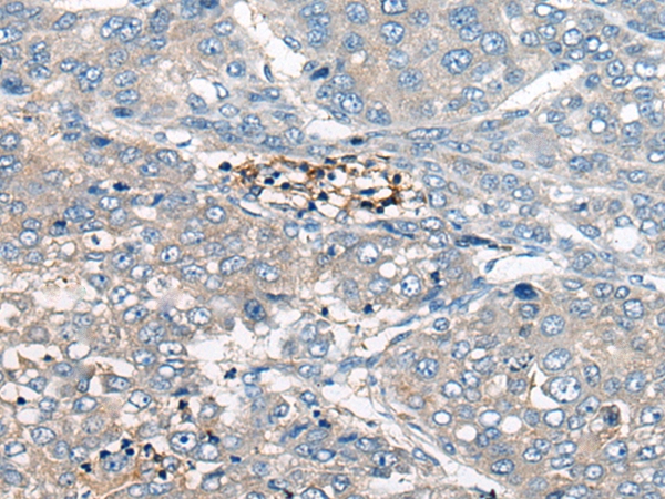 BASP1 Antibody