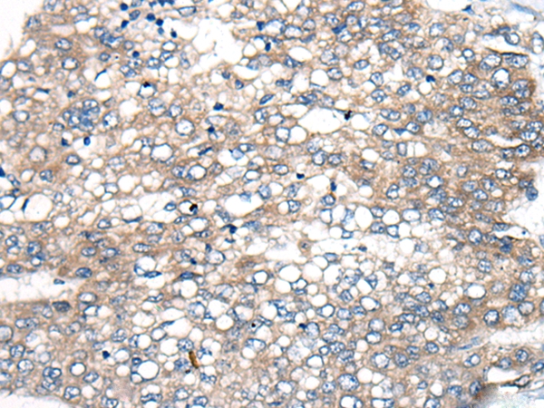 BBS12 Antibody