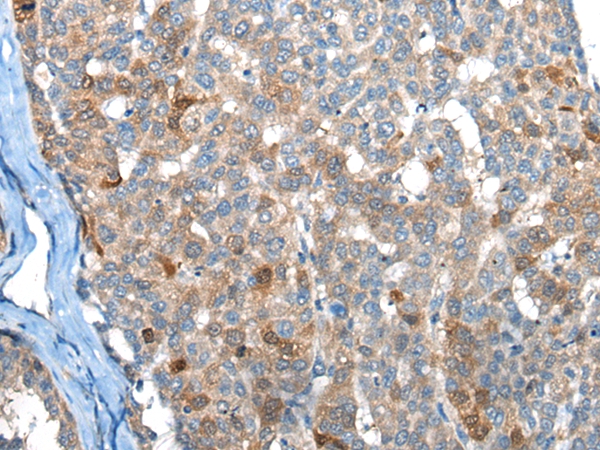 BHMT2 Antibody