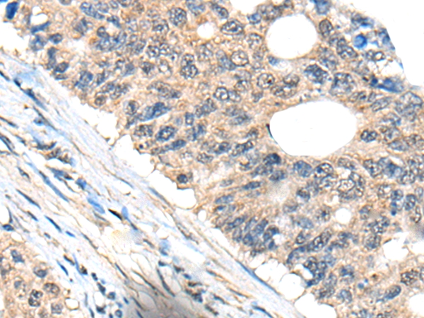 BHMT2 Antibody