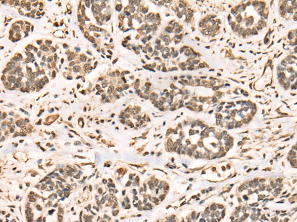 BRD7 Antibody