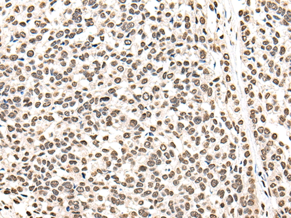 BRF1 Antibody