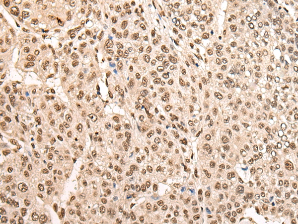 BRF1 Antibody