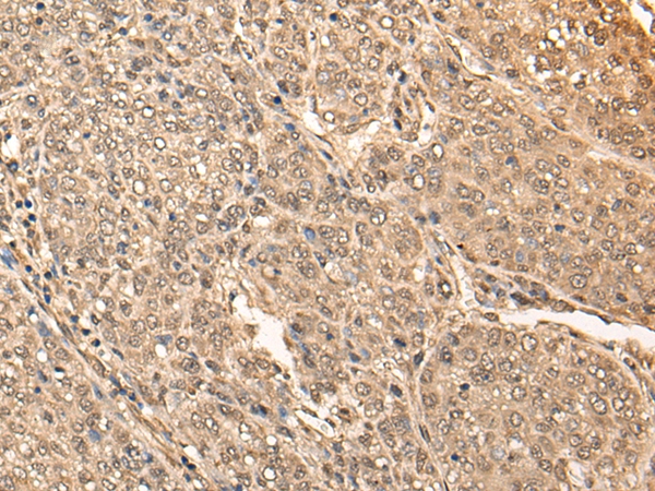 BRF2 Antibody