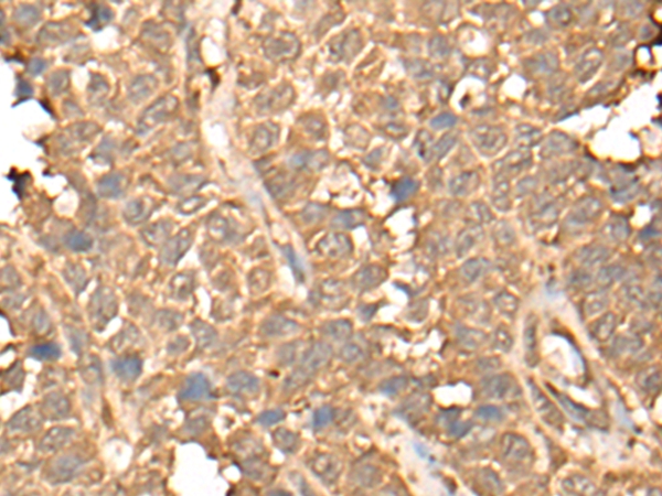 BTF3L4 Antibody