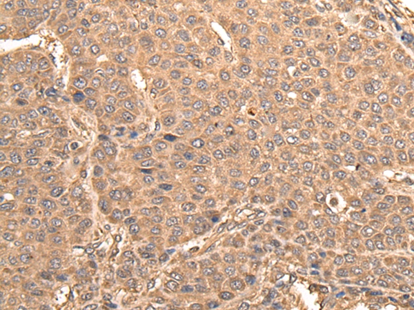 BUD31 Antibody