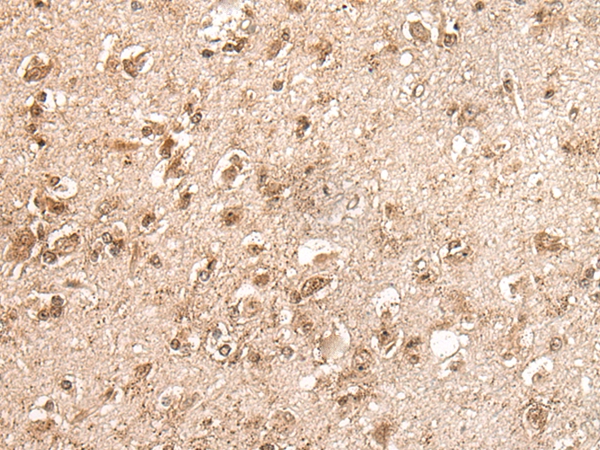 C12orf10 Antibody