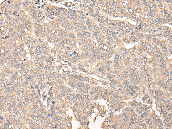 C12orf40 Antibody