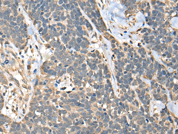 C14orf80 Antibody