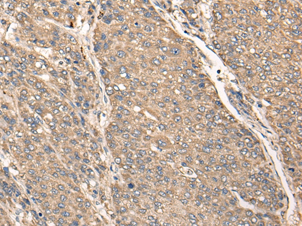 C17orf67 Antibody