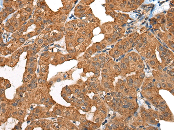 C18orf8 Antibody