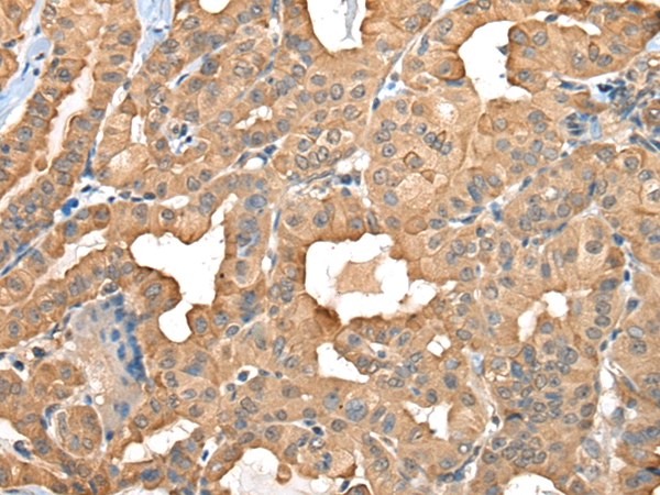 C1GALT1C1 Antibody