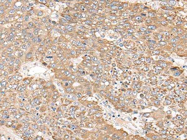 C1orf101 Antibody