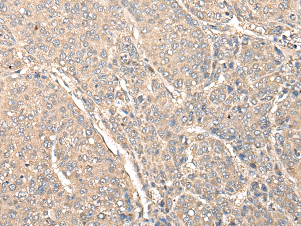 C1orf106 Antibody