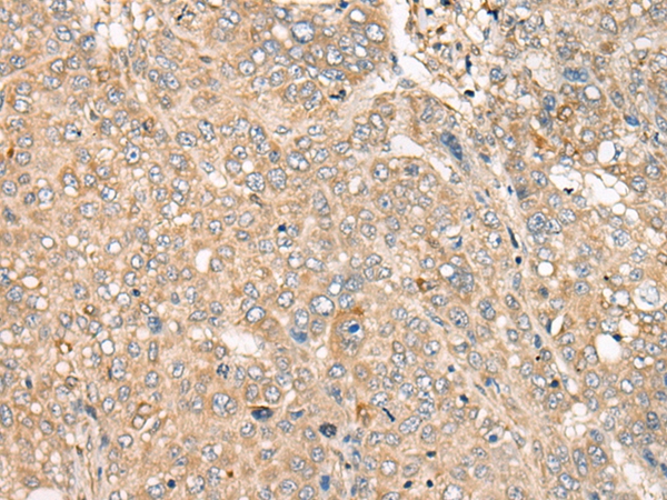 C21orf2 Antibody