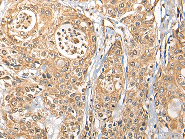 C21orf59 Antibody