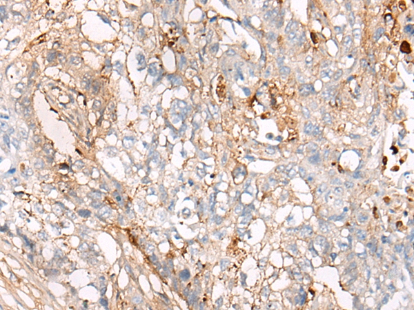 C4BPA Antibody