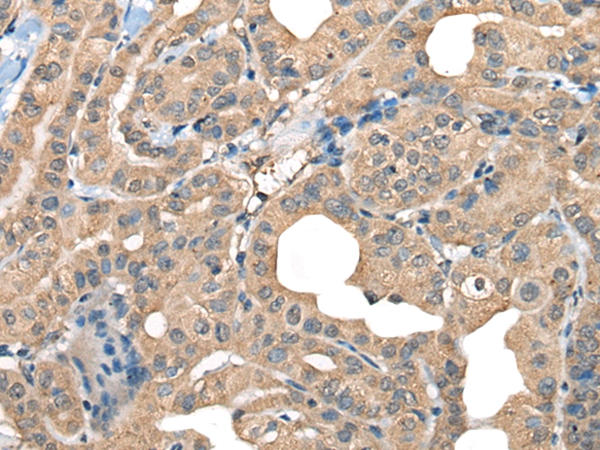 CABP5 Antibody