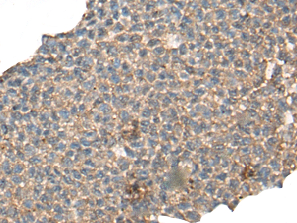 CABP5 Antibody