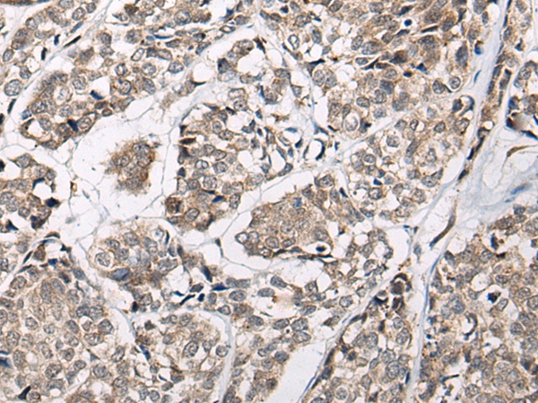 CACNB3 Antibody