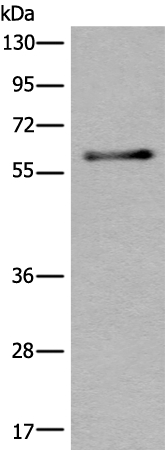 CACNB4 Antibody