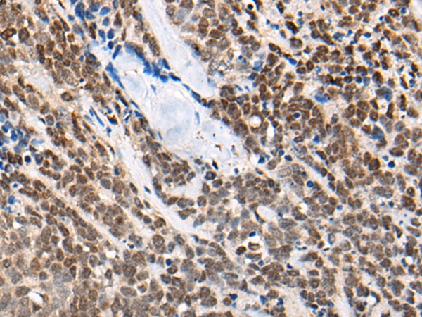 CACNB4 Antibody