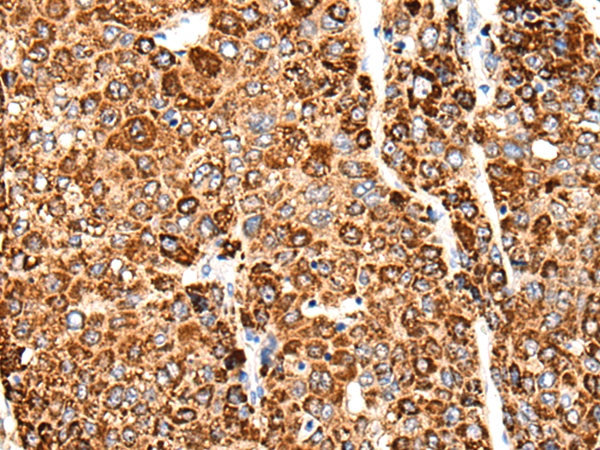 CACNG5 Antibody