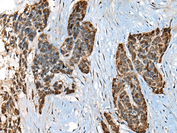 CALML5 Antibody