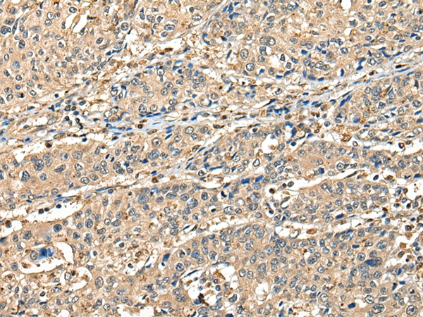 CCDC112 Antibody