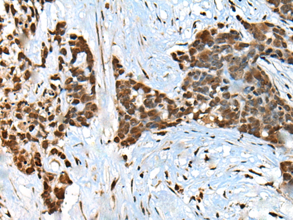 CCDC12 Antibody