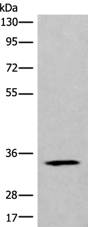 CCDC137 Antibody