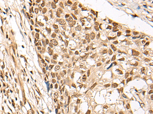 CCDC181 Antibody