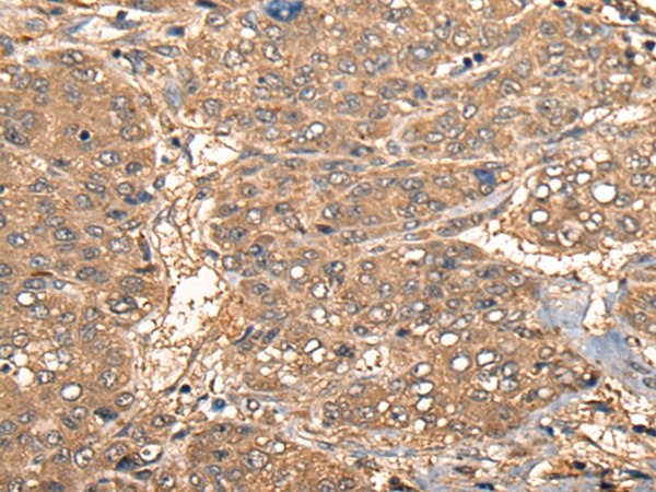 CCL27 Antibody