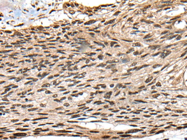 CCNB1IP1 Antibody