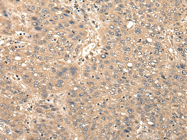 CCNYL1 Antibody