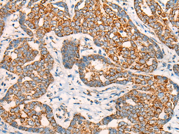 CCT8L2 Antibody