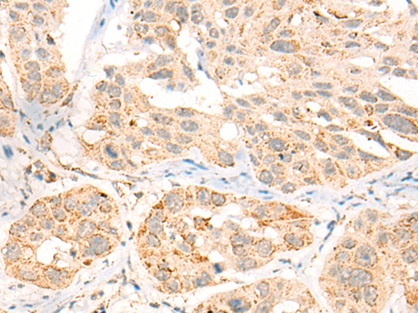 CCT8L2 Antibody