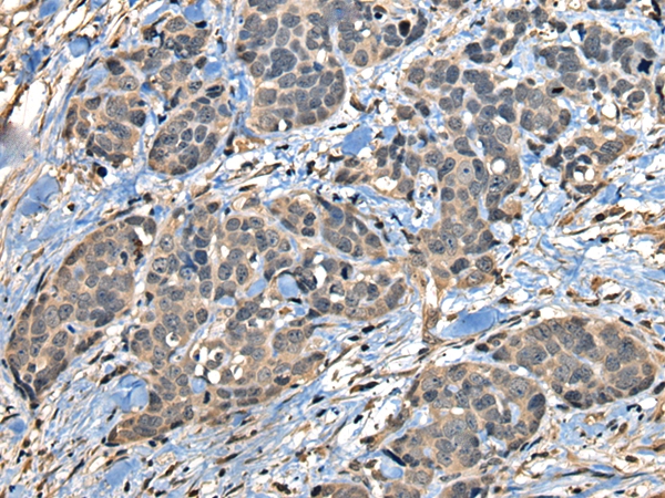 CDC14A Antibody