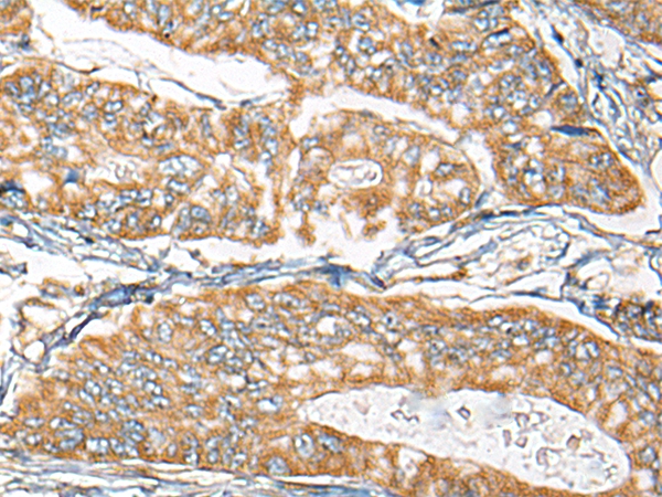 CDC42EP2 Antibody