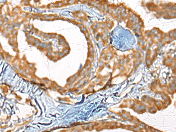 CDC42EP2 Antibody