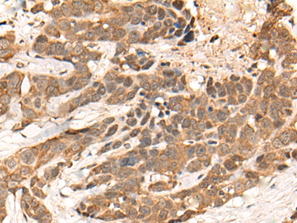 CDCA5 Antibody