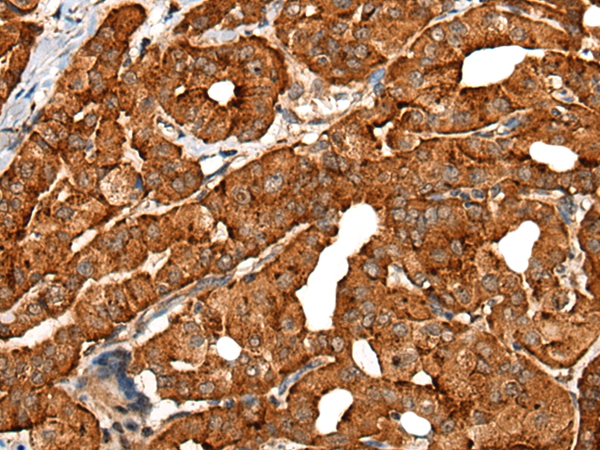 CDH16 Antibody