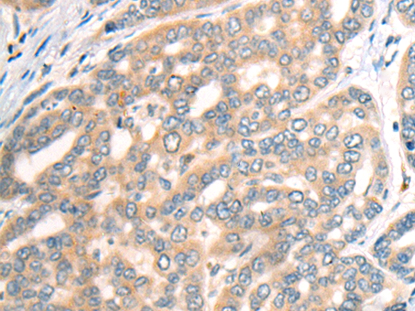 CDH19 Antibody