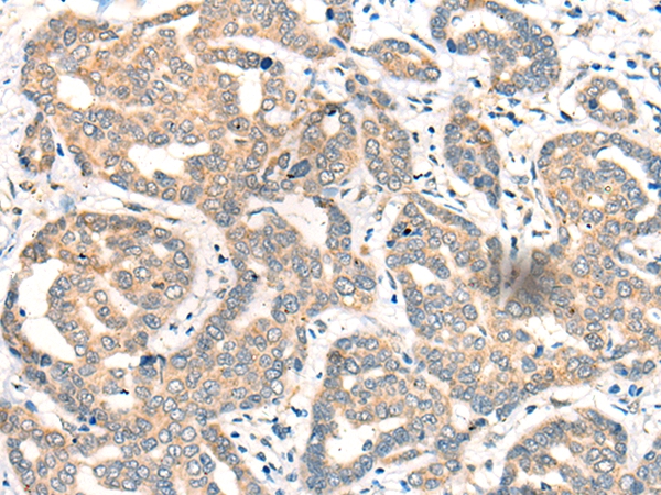 CDK2AP1 Antibody