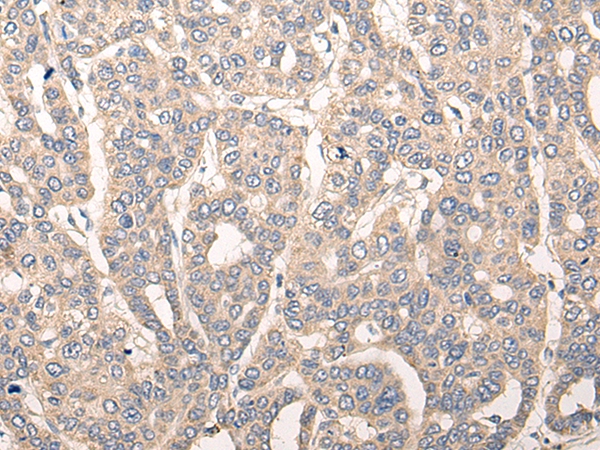 CDK2AP2 Antibody