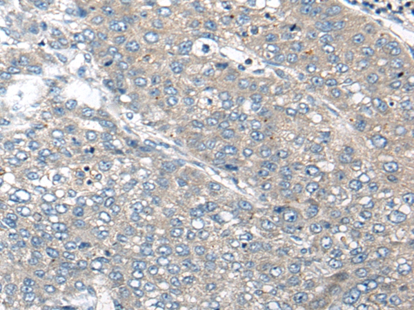 CDKL1 Antibody