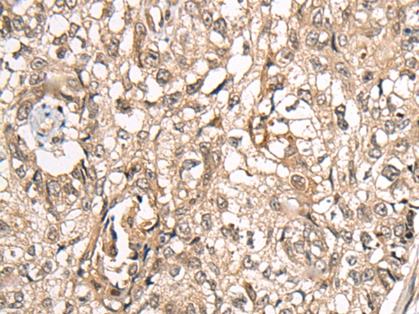 CDKL1 Antibody