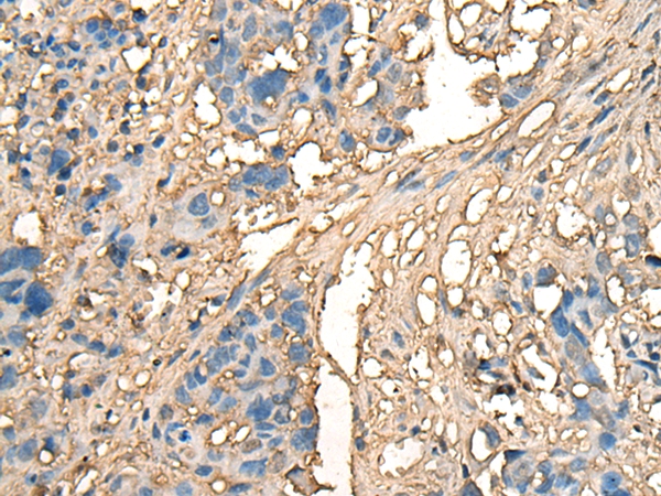 CELA1 Antibody