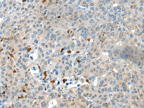 CELF4 Antibody